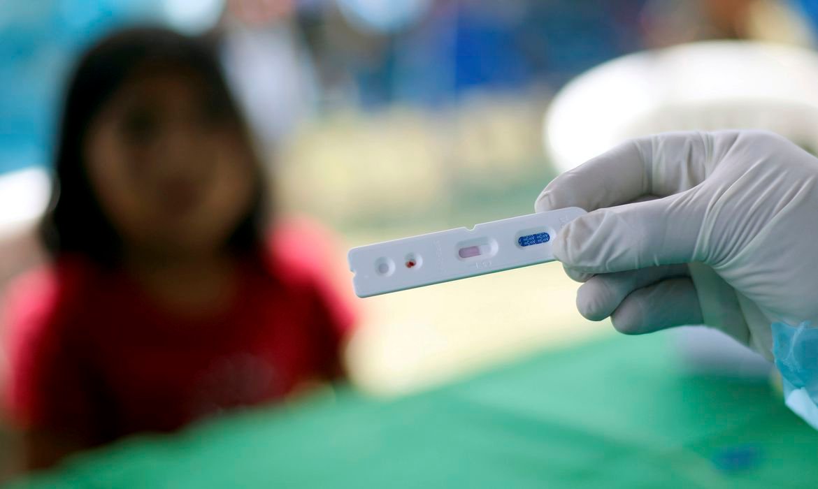 Goiás tem 1.250.989 casos de Covid-19 e 26.067 mortes Goiás tem 1.250.989 casos de Covid-19 e 26.067 mortes