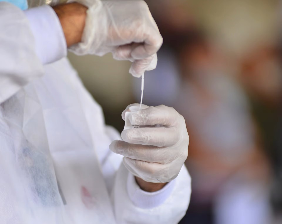 Brasil deve deixar de exigir teste de Covid-19 para entrar no País Brasil deve deixar de exigir teste de Covid-19 para entrar no País