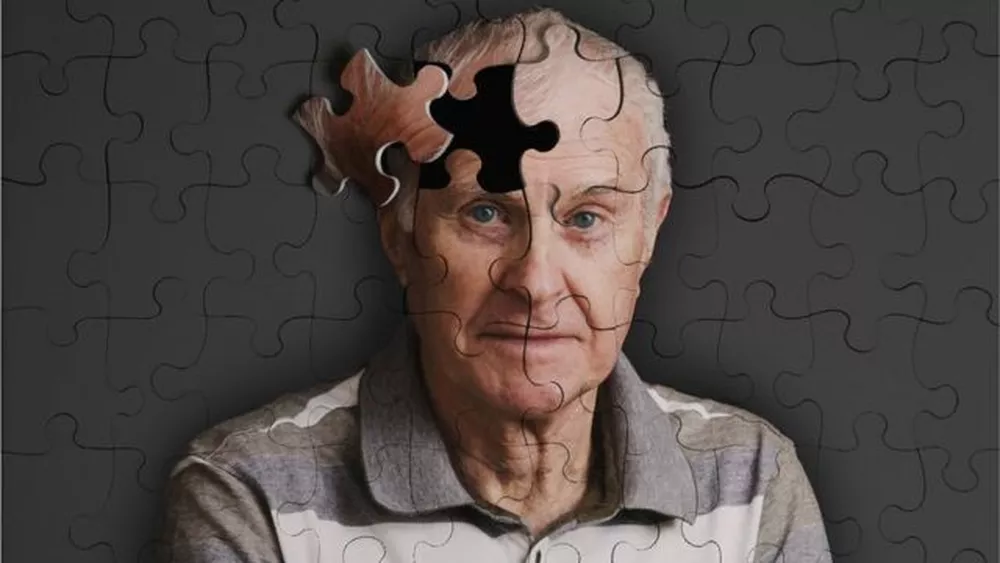 O que é demência vascular e como ela se diferencia do Alzheimer